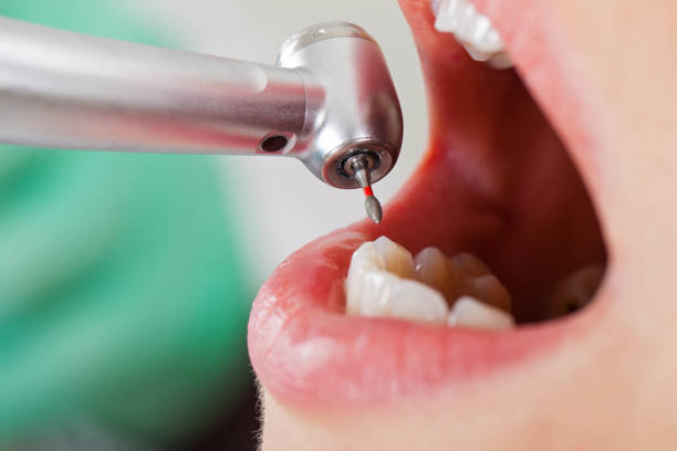 Best Cosmetic Emergency Dentistry in Central, LA